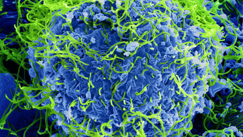 Descubren cómo la piel puede favorecer la transmisión del virus Ébola