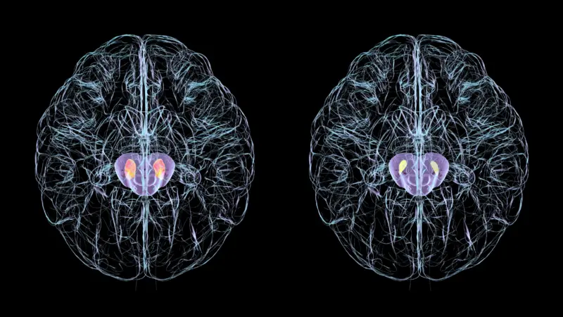 ¿Puede la estimulación tecnológica mejorar el funcionamiento de nuestro cerebro?