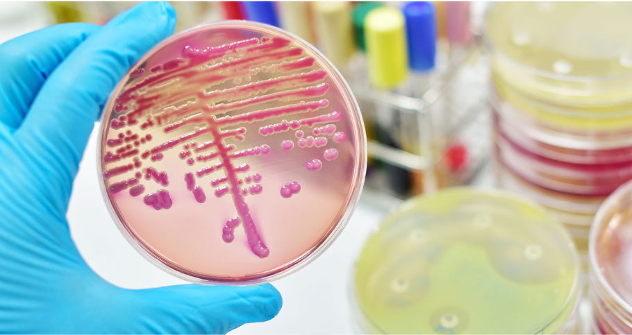Fallecen 13 niños del Edoméx con síntomas de la bacteria klebsiella oxytoca