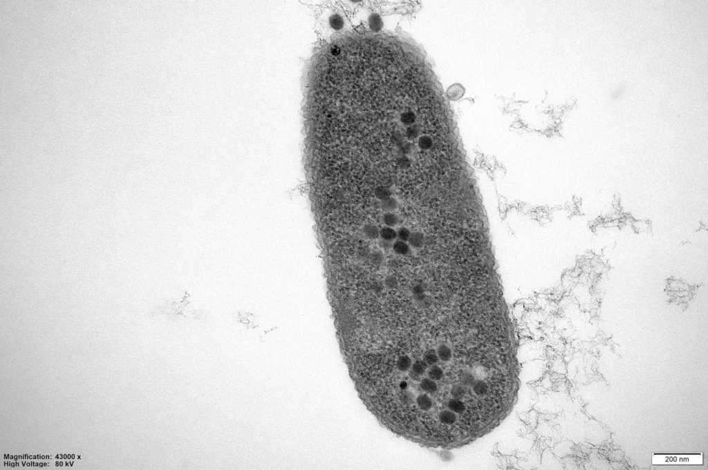 Descubren una bacteria de hace 5.000 años bajo el hielo resistente a 10 antibióticos modernos