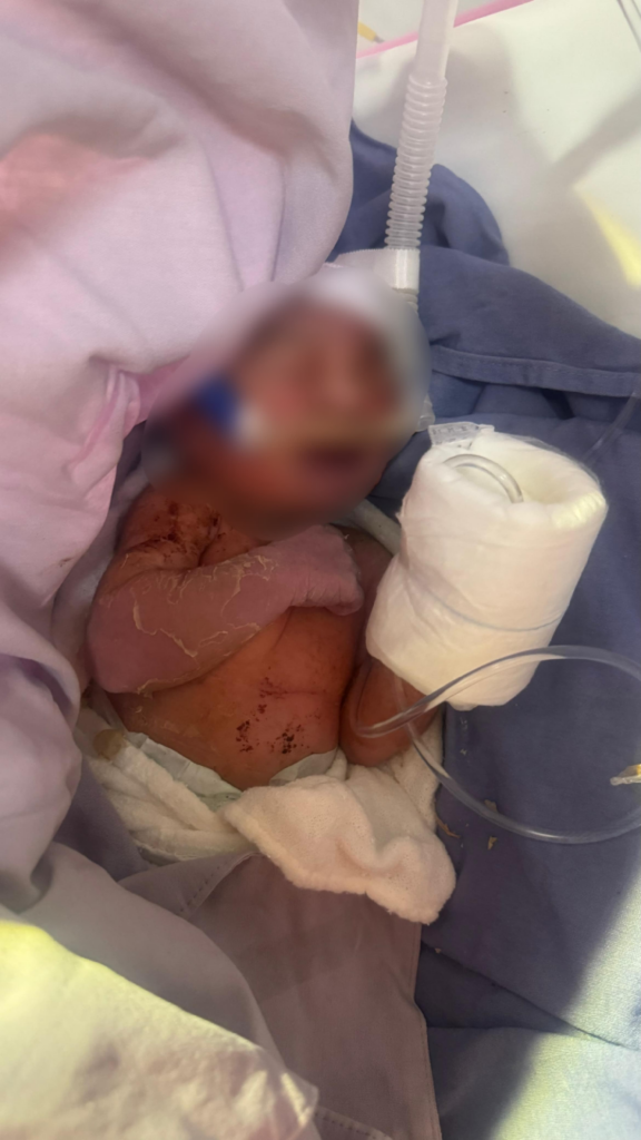 Policías de Ecatepec resguardan a recién nacida abandonada en vía pública