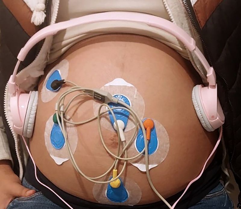 Investigadores UAEMéx revisan efecto de la música en actividad cardiaca fetal