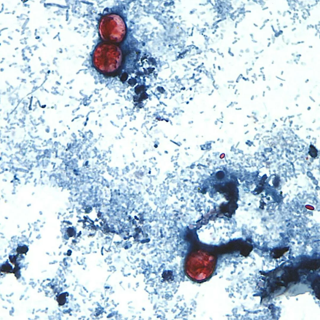 Brote de ciclosporiasis pone en alerta a Míchigan