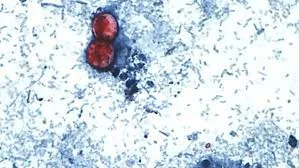 Alerta por Cyclospora en México tras confirmarse 33 casos
